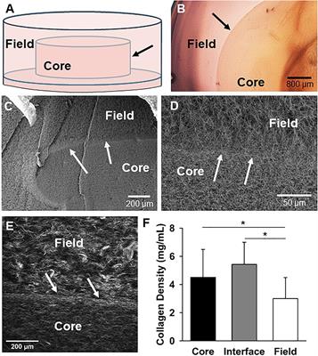 Stromal Cells Promote Neovascular Invasion Across Tissue Interfaces